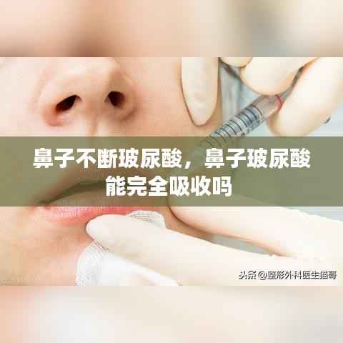 鼻子不断玻尿酸,鼻子玻尿酸能完全吸收吗