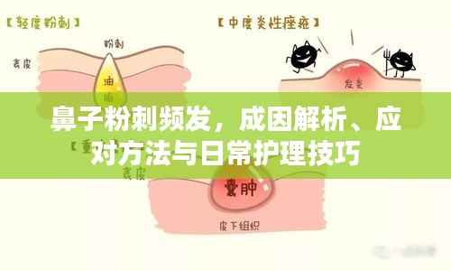 鼻子粉刺频发,成因解析、应对方法与日常护理技巧